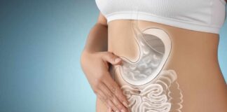 Illustration of a woman's digestive system with a focus on the stomach