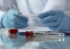 Ebola test tube on lab table with gloved researcher in background