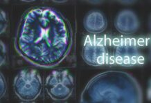 Brain MRI scans with highlighted section and text overlay