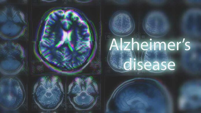 Brain MRI scans with highlighted section and text overlay