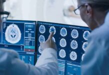 Sound Waves Tame Delusions – Trial Stuns Doctors reviewing brain MRI scans on multiple monitors